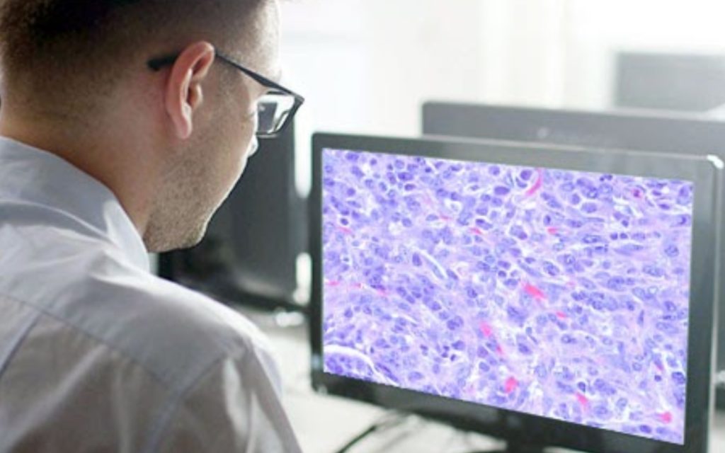 PathologyWatch Radically Improves Skin Cancer Diagnostics for Dermatologists